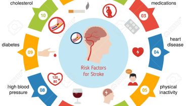 Understanding Stroke Risk Factors and Prevention